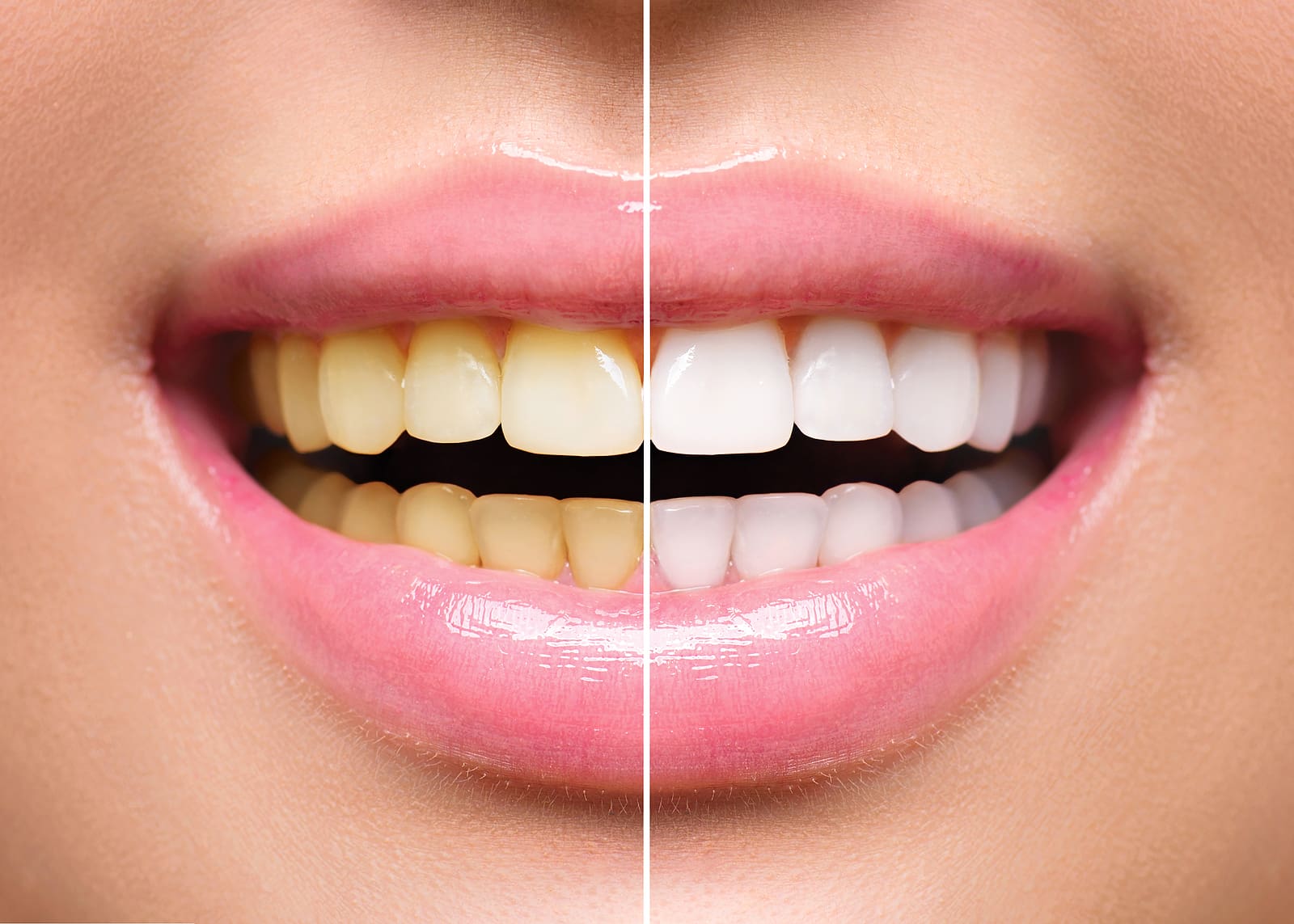 Early orthodontic care benefits children's dental health 2 Early orthodontic care benefits children's dental health